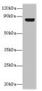 Testis Specific 10 antibody, CSB-PA863172LA01HU, Cusabio, Western Blot image 