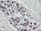 Phosphorylase Kinase Catalytic Subunit Gamma 2 antibody, LS-C797851, Lifespan Biosciences, Immunohistochemistry paraffin image 