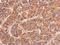 HSP70 antibody, NBP2-16898, Novus Biologicals, Immunohistochemistry paraffin image 