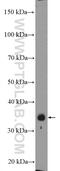 Zinc Finger CCCH-Type Containing 8 antibody, 26152-1-AP, Proteintech Group, Western Blot image 