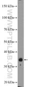Zinc Finger CCCH-Type Containing 8 antibody, 26152-1-AP, Proteintech Group, Western Blot image 