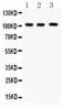 Itchy E3 Ubiquitin Protein Ligase antibody, PB9496, Boster Biological Technology, Western Blot image 