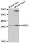 Heart And Neural Crest Derivatives Expressed 2 antibody, PA5-77111, Invitrogen Antibodies, Western Blot image 