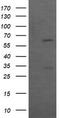 Chaperonin Containing TCP1 Subunit 8 Like 2 antibody, TA505303AM, Origene, Western Blot image 