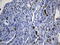 Macrophage Scavenger Receptor 1 antibody, LS-C797043, Lifespan Biosciences, Immunohistochemistry paraffin image 