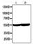 Cytochrome P450 Family 2 Subfamily E Member 1 antibody, PB9190, Boster Biological Technology, Western Blot image 