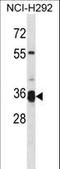 Transmembrane Serine Protease 12 antibody, LS-C162041, Lifespan Biosciences, Western Blot image 