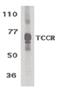 Interleukin 27 Receptor Subunit Alpha antibody, PA5-19985, Invitrogen Antibodies, Western Blot image 