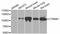 Catenin Beta 1 antibody, STJ113822, St John