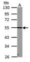 PHD Finger Protein 10 antibody, PA5-30678, Invitrogen Antibodies, Western Blot image 