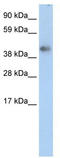 Zinc Finger Protein 620 antibody, TA329413, Origene, Western Blot image 