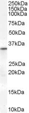 Voltage Dependent Anion Channel 2 antibody, LS-C55665, Lifespan Biosciences, Western Blot image 