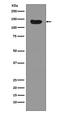 DNA Methyltransferase 3 Alpha antibody, M00136, Boster Biological Technology, Western Blot image 