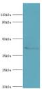 Histone Deacetylase 8 antibody, LS-C375898, Lifespan Biosciences, Western Blot image 