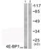 Eukaryotic Translation Initiation Factor 4E Binding Protein 1 antibody, abx012768, Abbexa, Western Blot image 
