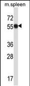 Megakaryocyte-Associated Tyrosine Kinase antibody, PA5-48676, Invitrogen Antibodies, Western Blot image 