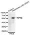 Receptor Interacting Serine/Threonine Kinase 3 antibody, abx004160, Abbexa, Western Blot image 