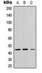 Cathepsin C antibody, orb234785, Biorbyt, Western Blot image 
