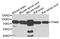 P21 (RAC1) Activated Kinase 6 antibody, A7821, ABclonal Technology, Western Blot image 
