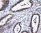 MCL1 Apoptosis Regulator, BCL2 Family Member antibody, LS-C115035, Lifespan Biosciences, Immunohistochemistry paraffin image 