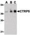 C1q And TNF Related 5 antibody, GTX85670, GeneTex, Western Blot image 