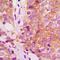 Phosphatidylinositol Glycan Anchor Biosynthesis Class W antibody, orb215408, Biorbyt, Immunohistochemistry paraffin image 