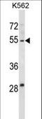 Hyaluronidase 4 antibody, LS-C165095, Lifespan Biosciences, Western Blot image 