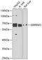 Serpin Family F Member 2 antibody, A04248, Boster Biological Technology, Western Blot image 