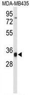 TCF3 Fusion Partner antibody, GTX80425, GeneTex, Western Blot image 