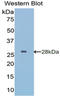 Insulin Like Growth Factor Binding Protein 5 antibody, LS-C303289, Lifespan Biosciences, Western Blot image 