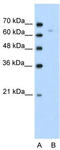 TOX antibody, TA334230, Origene, Western Blot image 