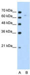 Thymocyte selection-associated high mobility group box protein TOX antibody, TA334230, Origene, Western Blot image 