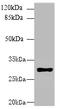 Major Histocompatibility Complex, Class II, DR Beta 4 antibody, A59382-100, Epigentek, Western Blot image 