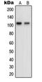 OCRL Inositol Polyphosphate-5-Phosphatase antibody, orb214344, Biorbyt, Western Blot image 