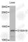 S100 Calcium Binding Protein A16 antibody, A6005, ABclonal Technology, Western Blot image 