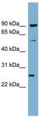Vesicle Associated Membrane Protein 7 antibody, TA342435, Origene, Western Blot image 