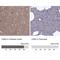 Cyclin Dependent Kinase 5 antibody, NBP2-55870, Novus Biologicals, Immunohistochemistry paraffin image 
