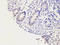 Snail Family Transcriptional Repressor 1 antibody, orb180479, Biorbyt, Immunohistochemistry paraffin image 