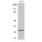 Casein Kinase 2 Beta antibody, LS-C382439, Lifespan Biosciences, Western Blot image 