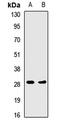 Major Histocompatibility Complex, Class II, DR Alpha antibody, orb411887, Biorbyt, Western Blot image 