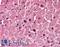 Purinergic Receptor P2X 6 antibody, LS-B154, Lifespan Biosciences, Immunohistochemistry frozen image 