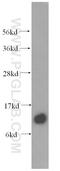 Signal Peptidase Complex Subunit 1 antibody, 11847-1-AP, Proteintech Group, Western Blot image 