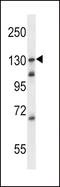 Toll Like Receptor 9 antibody, LS-C161924, Lifespan Biosciences, Western Blot image 