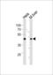 T-Box 6 antibody, 55-978, ProSci, Western Blot image 