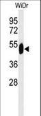 SET Domain Containing 6, Protein Lysine Methyltransferase antibody, LS-C169002, Lifespan Biosciences, Western Blot image 