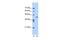 Adipocyte Plasma Membrane Associated Protein antibody, GTX46051, GeneTex, Western Blot image 