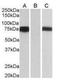 Forkhead Box C1 antibody, NB100-1268, Novus Biologicals, Western Blot image 