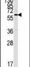 Calcium/Calmodulin Dependent Protein Kinase II Alpha antibody, PA5-14033, Invitrogen Antibodies, Western Blot image 