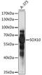 SRY-Box 10 antibody, LS-C750074, Lifespan Biosciences, Western Blot image 