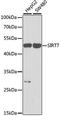 Sirtuin 7 antibody, A0979, ABclonal Technology, Western Blot image 